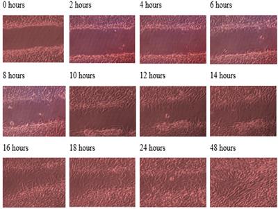 Effect of TGF-β3 on wound healing of bone cell monolayer in static and hydrodynamic shear stress conditions